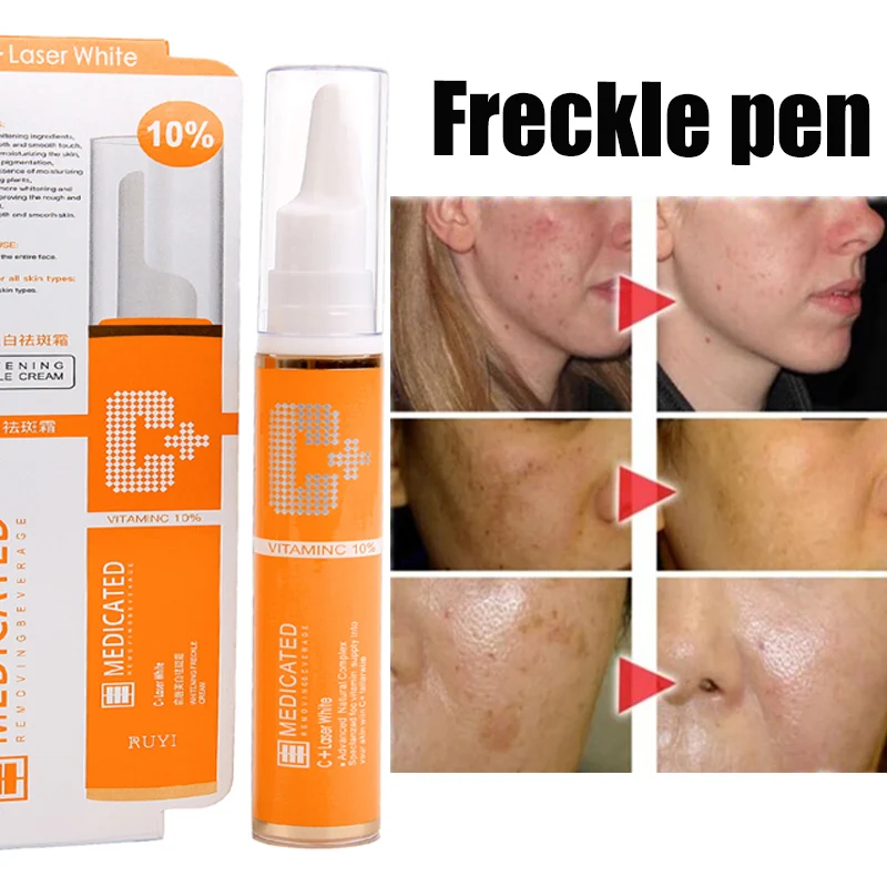 Крем с витамином C для удаления веснушек пигментированных пятен меланина