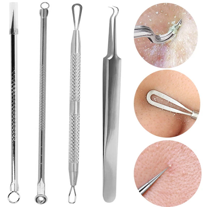 Stainless Steel Acne Removal Needles Pimple Blackhead Remover Tools Spoons Face Skin Care Facial Pore Cleaner |