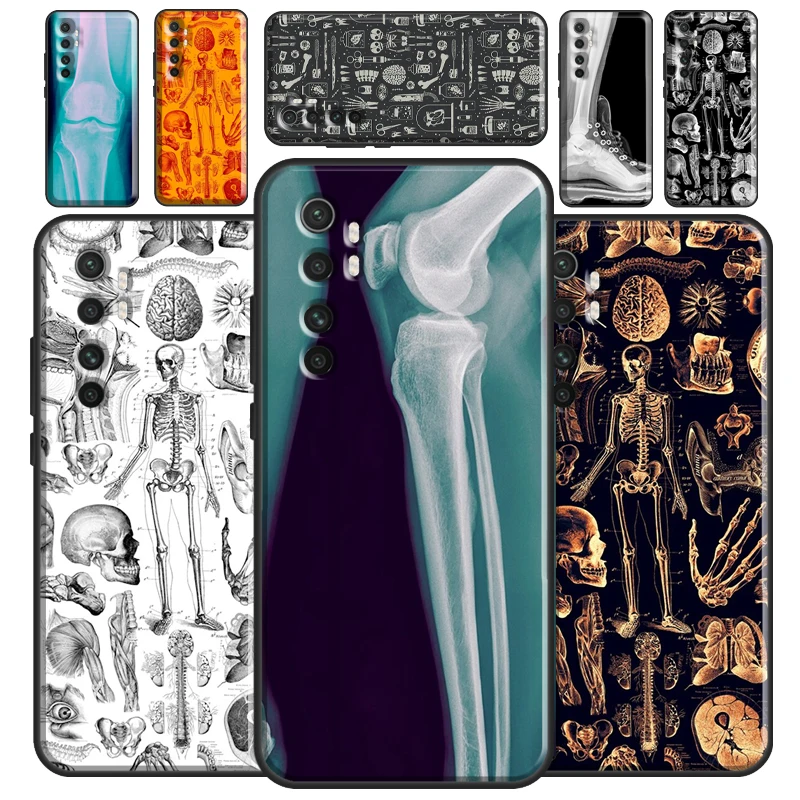 Чехол для Xiaomi Mi 12 11T Pro 11 Lite Ultra POCO F3 F1 F2 M3 M4 X4 GT X3 с рентгеновским изображением анатомии человека.