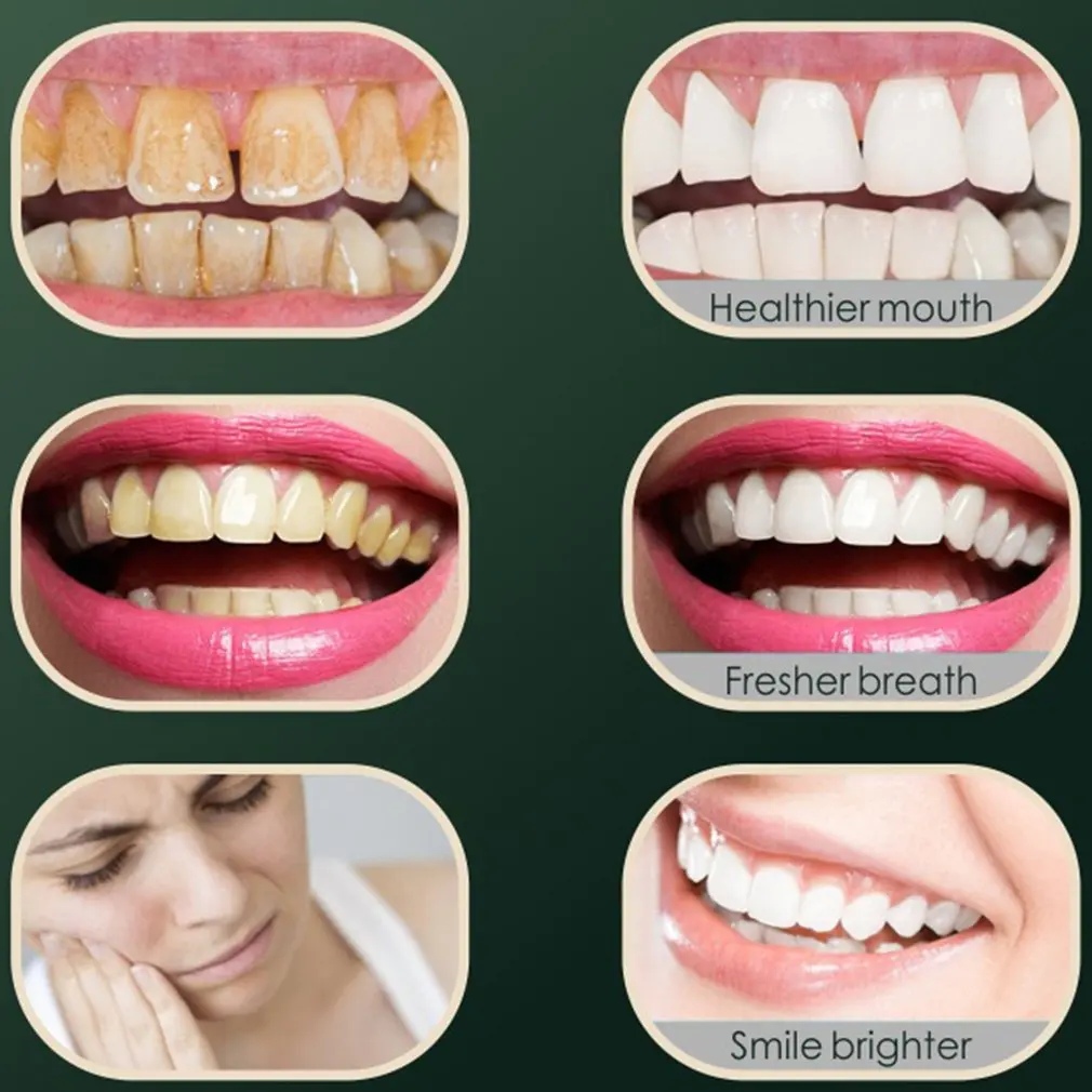 

Electric Toothbrush 3 Types Of Brush Head Cleaning Adult Toothbrush Ultrasonic Usb Charging Waterproof