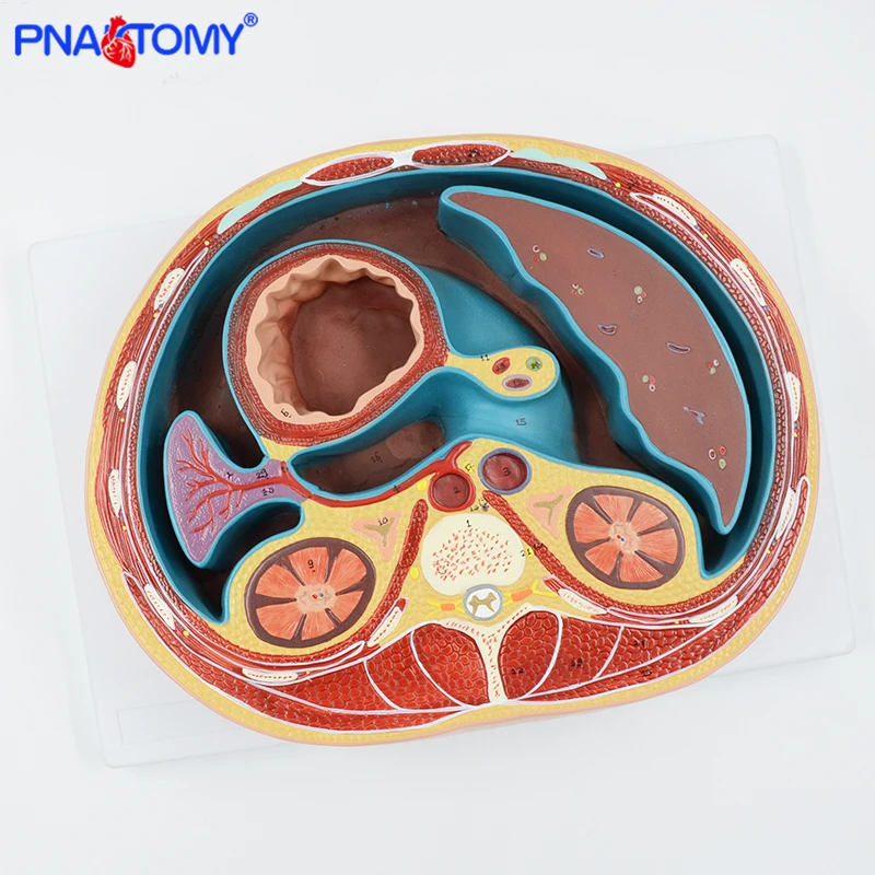 SCHEMATIC CROSS SECTION THROUGH THORAX (T8) HUMAN ANATOMICAL MODEL LIVER MUSCLE MEDICAL TOOL EDUCATIONAL EQUIPMENT PNATOMY 10x enlarge human arterial arteriosclerosis atherosclerosis coronary cross section
