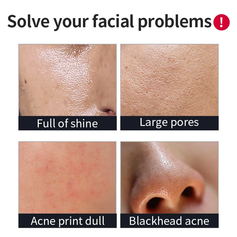 400 г набор для очищения молока утреннее и вечернее масло контроля акне черных