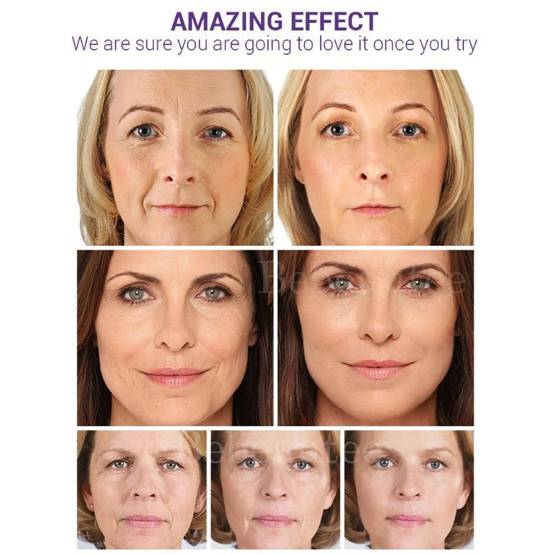 Сыворотка для лица Lanbena увлажняет кожу экстрактор черники пептид с гиалуроновой