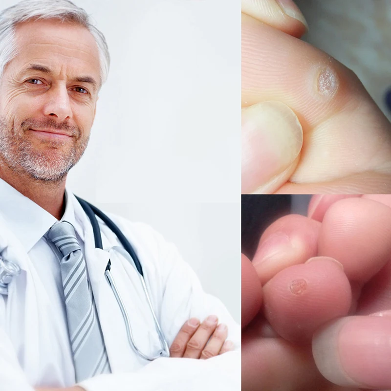 6 шт. пластырь для удаления мозолей на ногах|Уличные инструменты| |