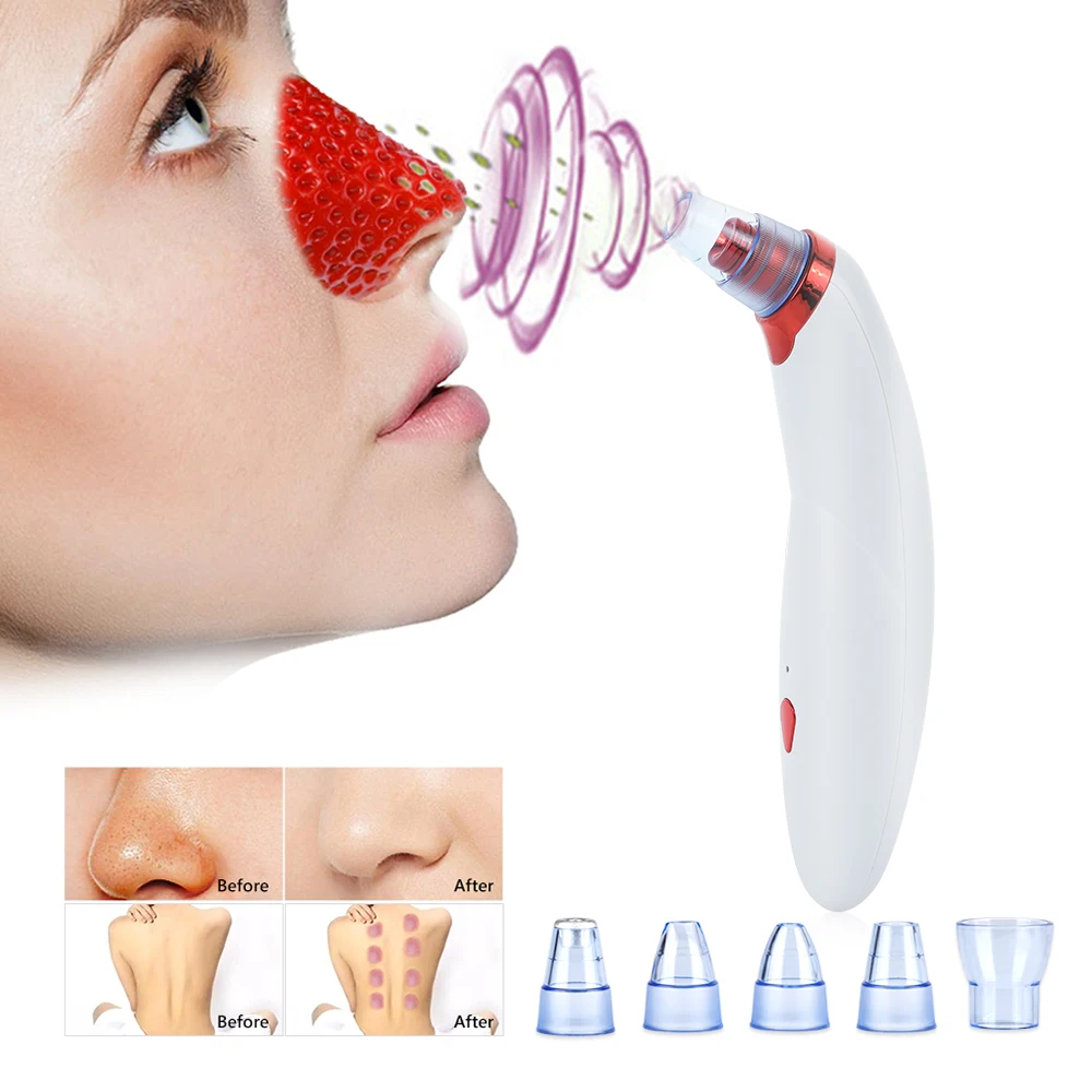 Вакуумный аппарат для удаления черных точек|Устройство ухода за кожей лица| |