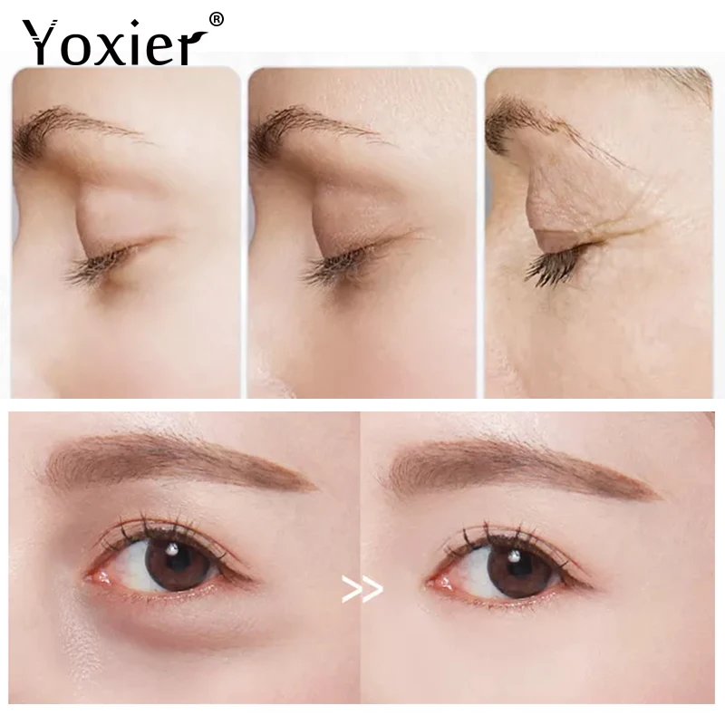 Yoxier, Золотая коллагеновая Белковая маска для глаз, Уход за глазами, тонкие линии под глазами, отечность, темные круги, увлажняющая, укрепляющая, против морщин