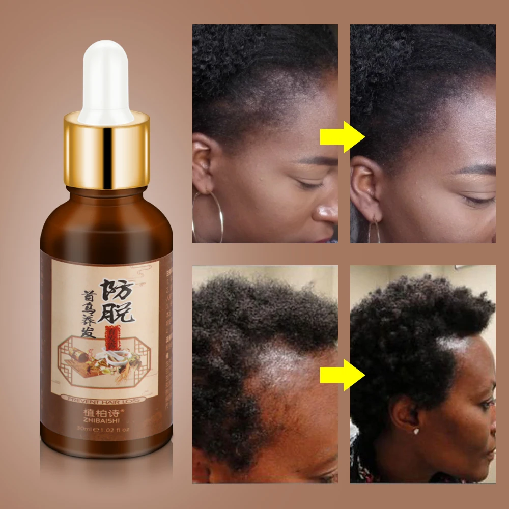 2 шт. масло для роста волос лечения выпадения бороды тоник | Красота и здоровье