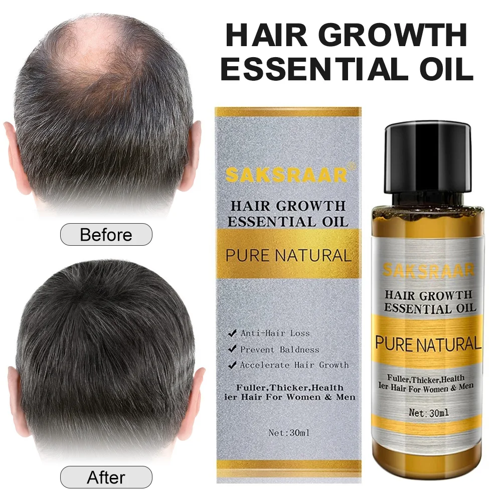 

30MLHair Growth Essence Oil Prevent Hair Loss and Baldness Hair Care Essence Nourish Repair Damaged Hairs Serum