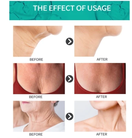 Шею и грудь крем сухой креп кожи восстановление повышение упругости супер против