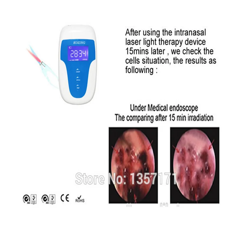650нм низкоуровневое лазерное устройство для интрансазольной светильник терапии