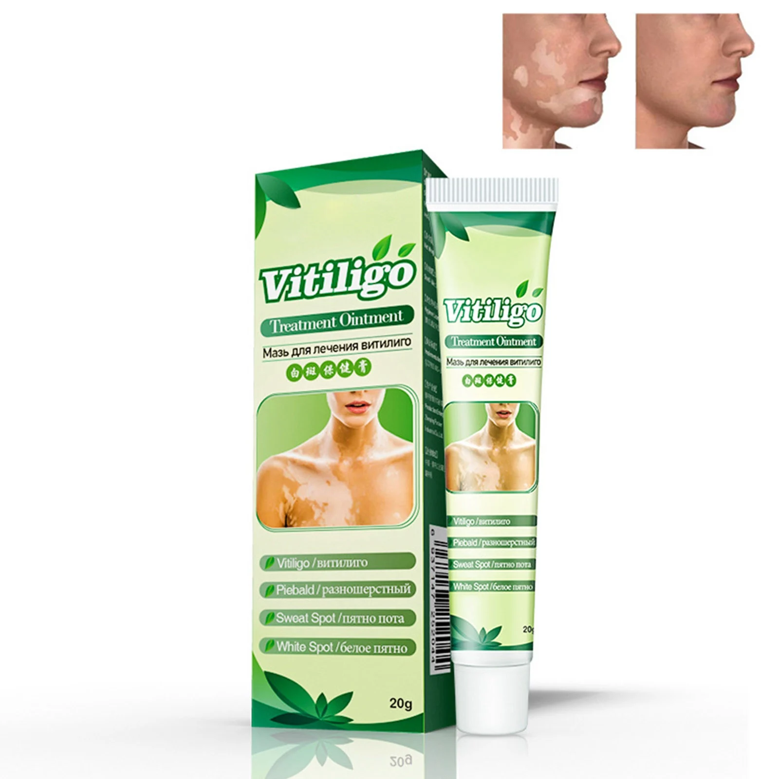 Мази от пигментации на теле. Pigmento ointment, 50 g, charak. Витилиго мазь. Пигменты мазь. Пигмент мазь.