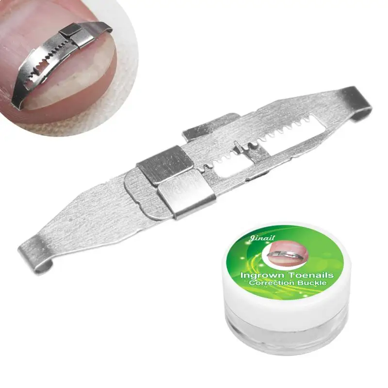 1 Set Nail Fixer 4 шт./компл. нержавеющая вросших носком фиксатор для НОГТЯ ПЕДИКЮР восстановить вставки для коррекции подъемник ящик для инструментов - Цвет: 1 Set Nail Fixer
