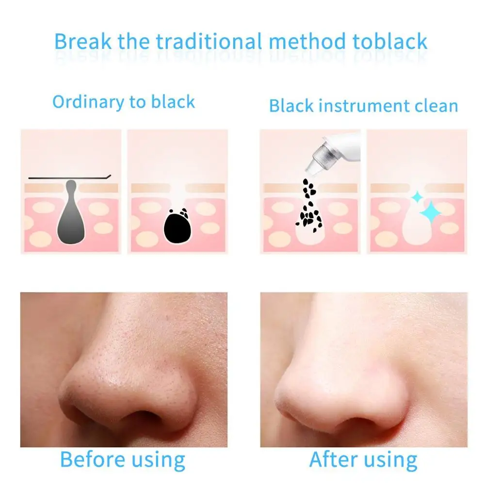 Мини-электрическое средство для очистки пор от угрей очиститель красоты