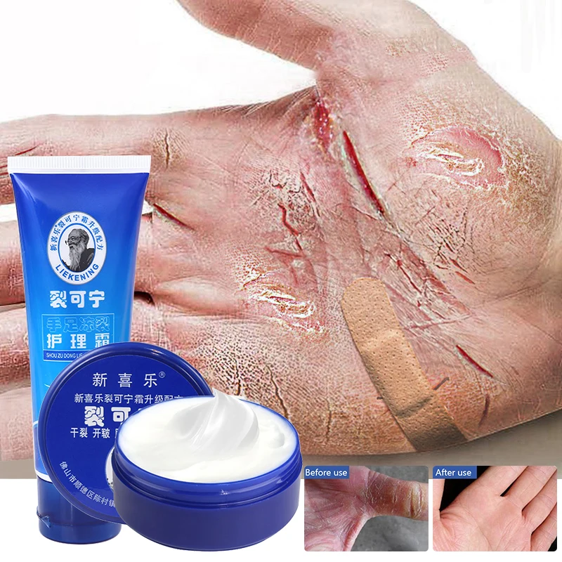 

Skin Care 33g Anti Crack Foot Cream Dryness Foot Mask Heel Cracked Repair Cream Hand Mositurizing Removal Callus Dead Skin Hands