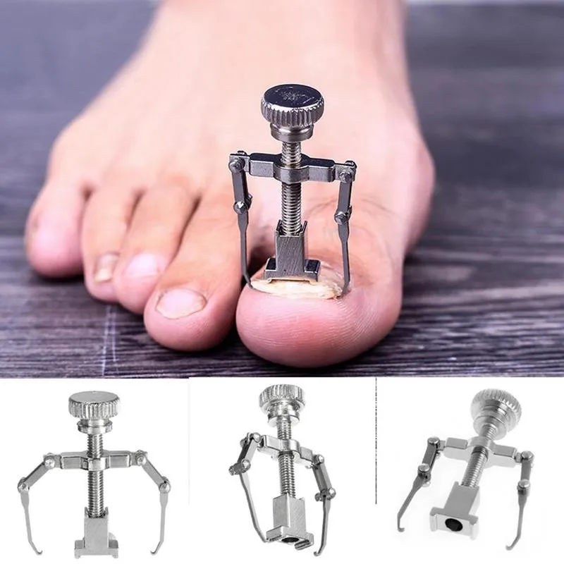 Steel Nail Art Correction Tool Of Foot Toe Nails Meat Claws Ingrown Orthosis Pedicure Tools Feet Corrector Health Care | Красота и
