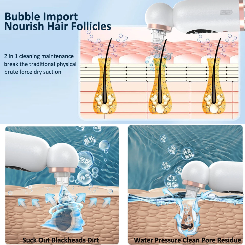 Средство для удаления черных точек на лице вакуумный аппарат глубокого очищения