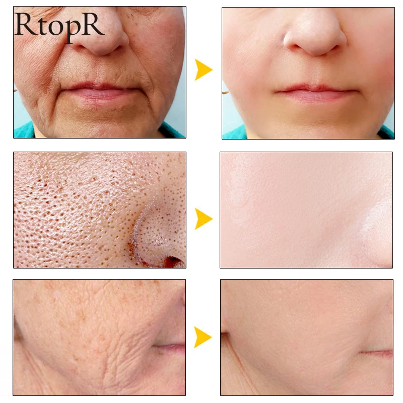 Гиалуроновая кислота увлажняющее средство для лица анти от морщин старение