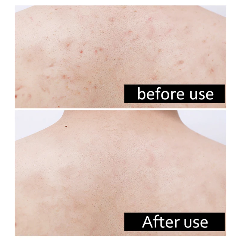 Отшелушивающий отбеливающий для тела 350 мл | Красота и здоровье