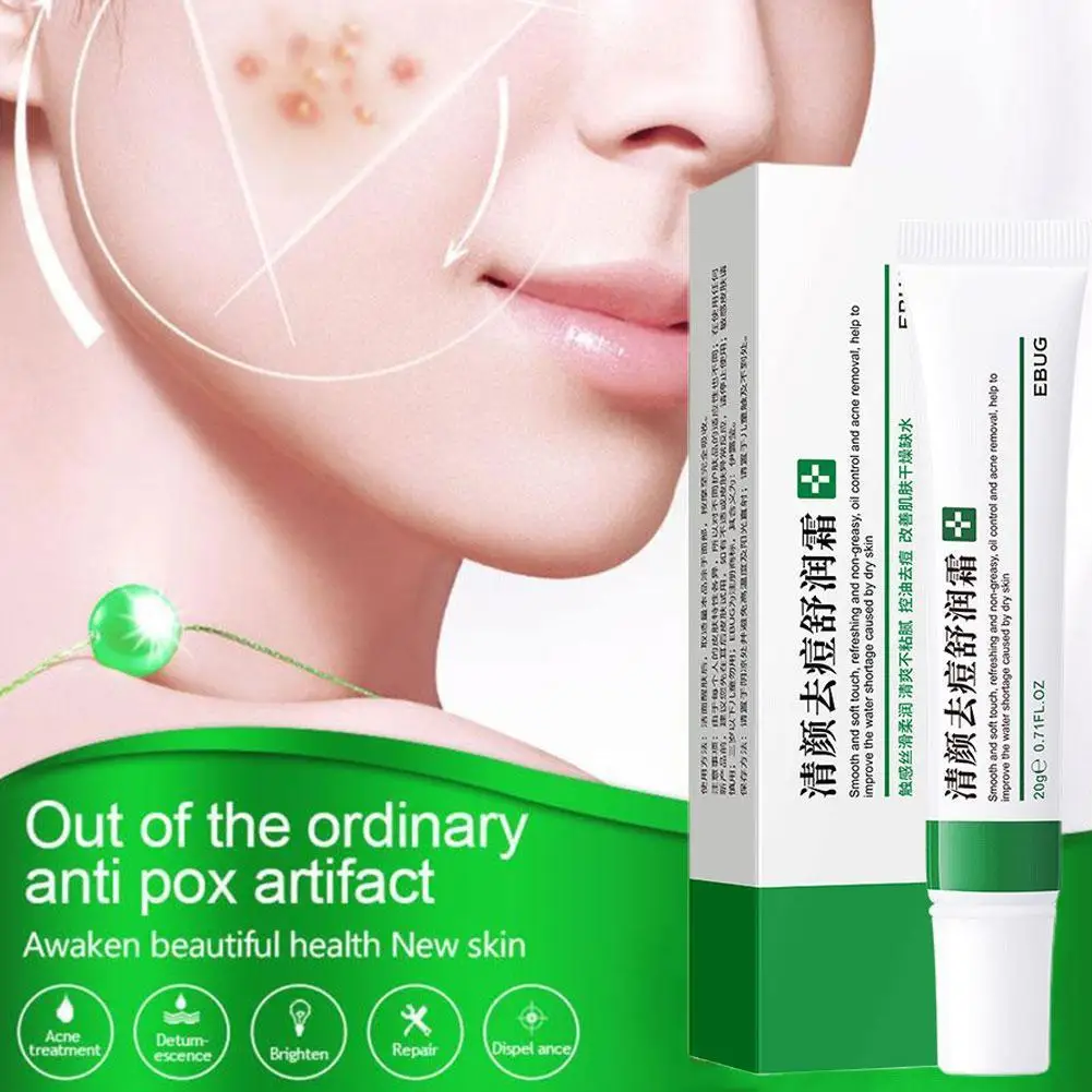 

20g Effective Acne Removal Cream Acne Treatment Fade Acne Spots Oil Control Shrink Pores Whitening Moisturizing Acne Skin Care