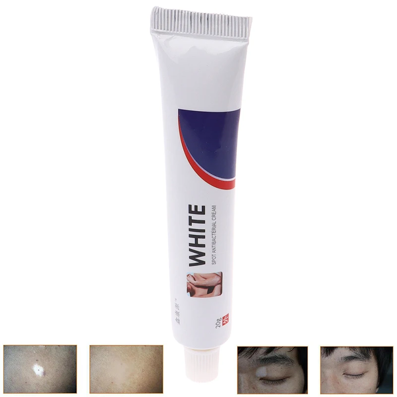 Китайский медицинский крем с белыми пятнами пигмент меланин стимулирующий