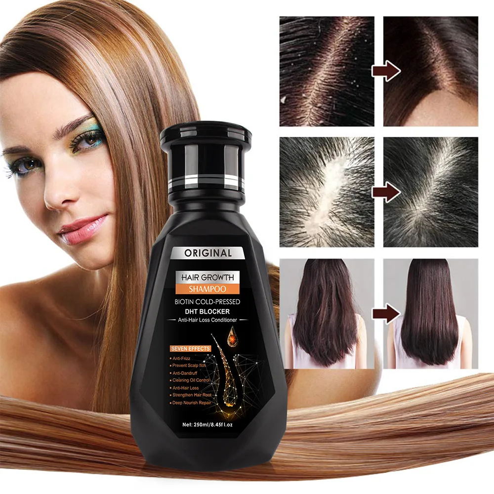

250ml Ginger Aloe Hair Growth Shampoo Soft Clean and Not Greasy Anti Frizz Anti-hair Loss Deep Nourish Repair