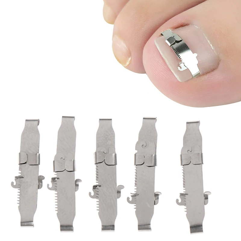 New Ingrown Toe foot Nail Correction Fixer Pedicure Tool Toenail Corrector | Красота и здоровье