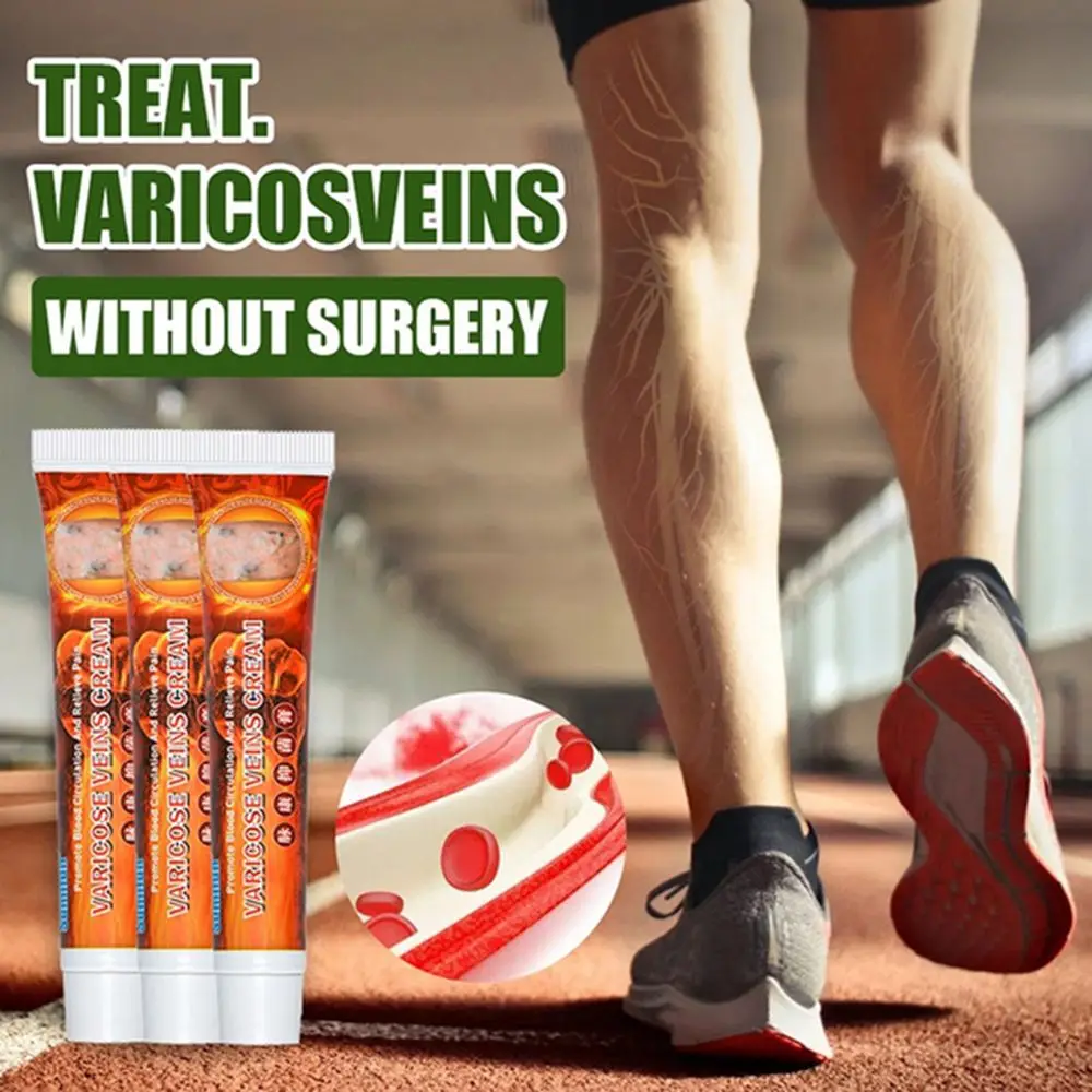 

Blood Vessel Rotten Phlebitis Angiitis Herbal Medical Plaster Vasculitis Cream Treatment Varicose Veins Ointment Cream
