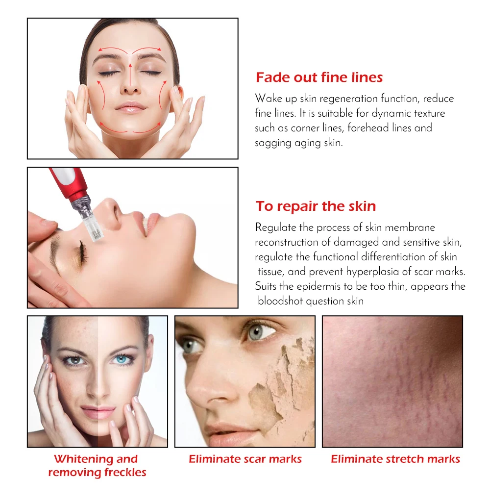 Красота Derma Авто ручка профессиональная электрическая микроиглы байонет Дерма