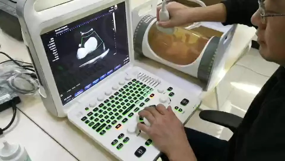 

Medical Equipment 3D Image Laptop Portable Color Doppler Pregnancy Diagnostic Ultrasound