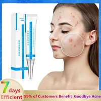 7 days effective herbal acne cream anti acne pimple treatment remove acne scars oil control shrink pores lighten melanin 30g
