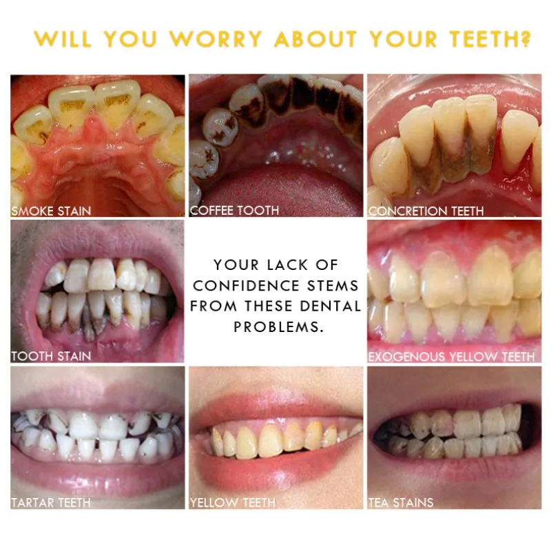 2018 Teeth Whitening Essence Oral Hygiene Cleaning Serum White Gel Care Remove smoke stains and Plaque Perfect Smile 10ml | Красота и