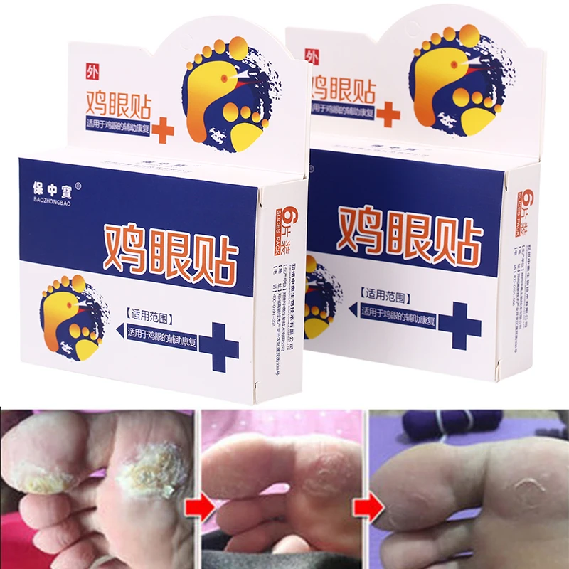 

6pcs Foot Corn Patch Foot Care Medical Plaster Foot Corn Removal Calluses Plantar Warts Thorn Plaster Relieving Pain
