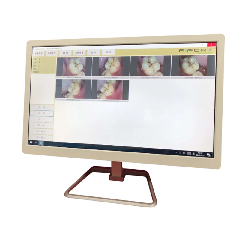 

Dental YF-2200I 21.5 Inch LED Touch Screen Computer Intraoral Camera