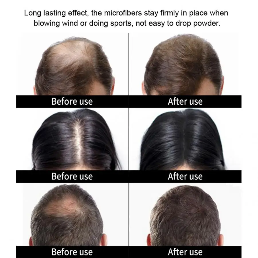 6 г выпадение волос профессиональное строительное волокно загуститель спрей для