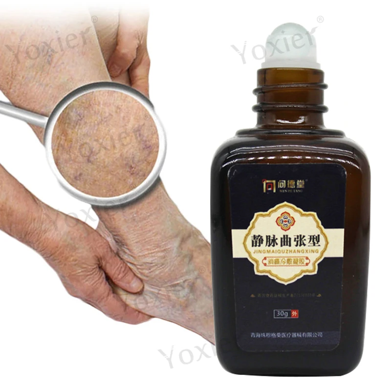 

Varicose Vein Gel Serum Leg Blood Vessels Raised Relieve Pain Cold Compress Calf Swelling Remove Earthworm Legs Skin Care 30g