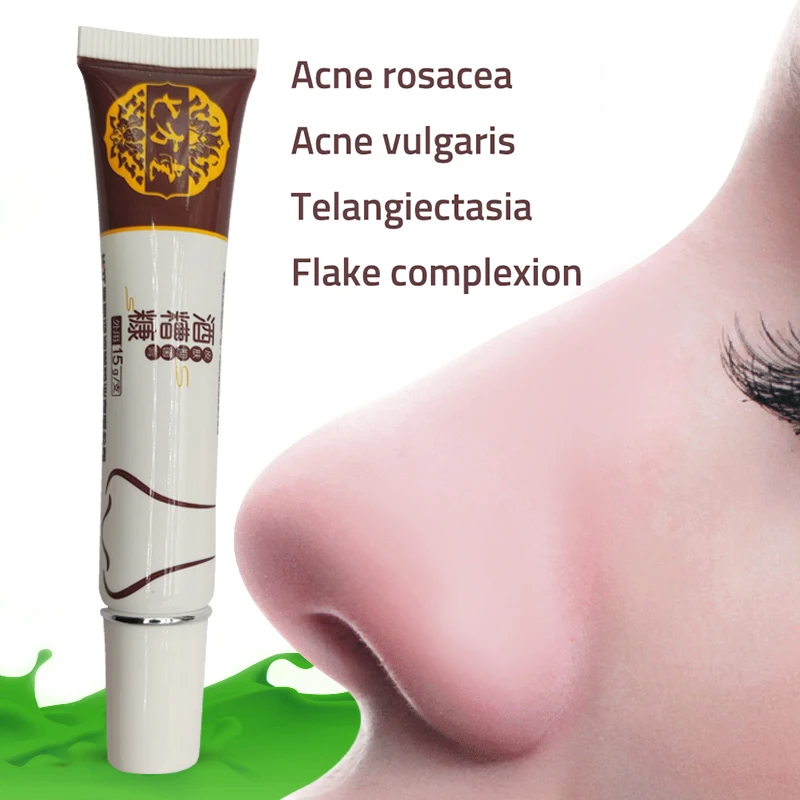 

Herbal Anti Nose Mites Remove Acne Rosacea Cream Red Nose Blackhead Remover Acne Treatment Shrink Pores Face Bleaching Ointment