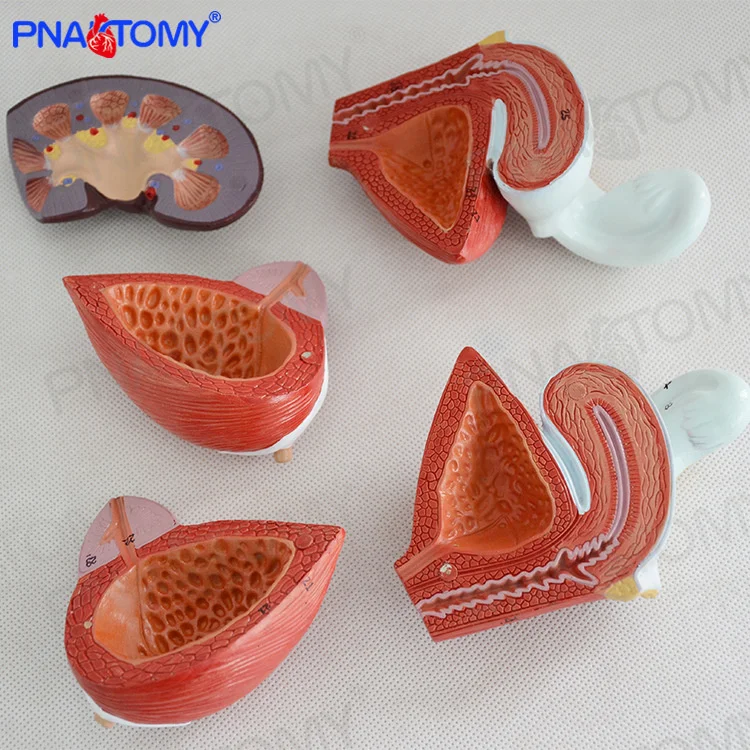 

and female urinary Male system bladder abdominal wall kidney anatomical model urology andrology gynecology