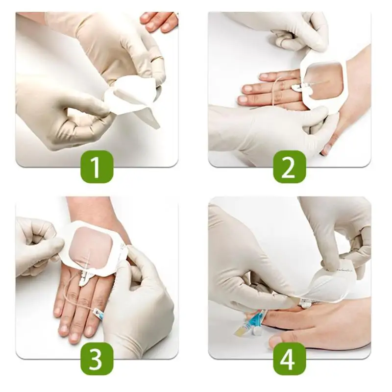 

10pcs Film Dressing Wound Cover Bandage Transparent Dressing Waterproof Adhesive Patch Catheter Stickers (6x7cm)