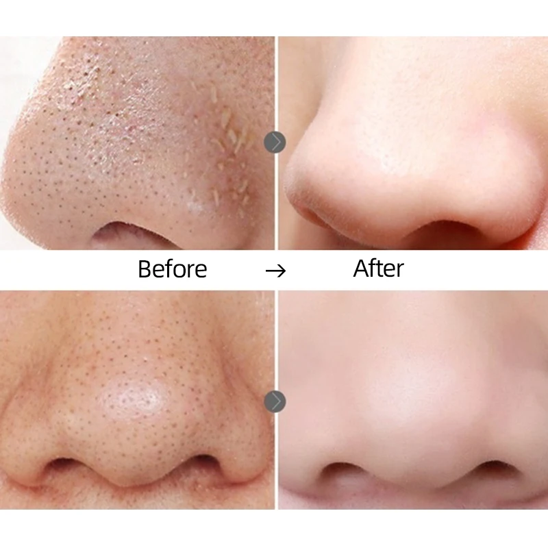 55g прополис из черного бамбукового угля мыло глубокая очистка лица тела!