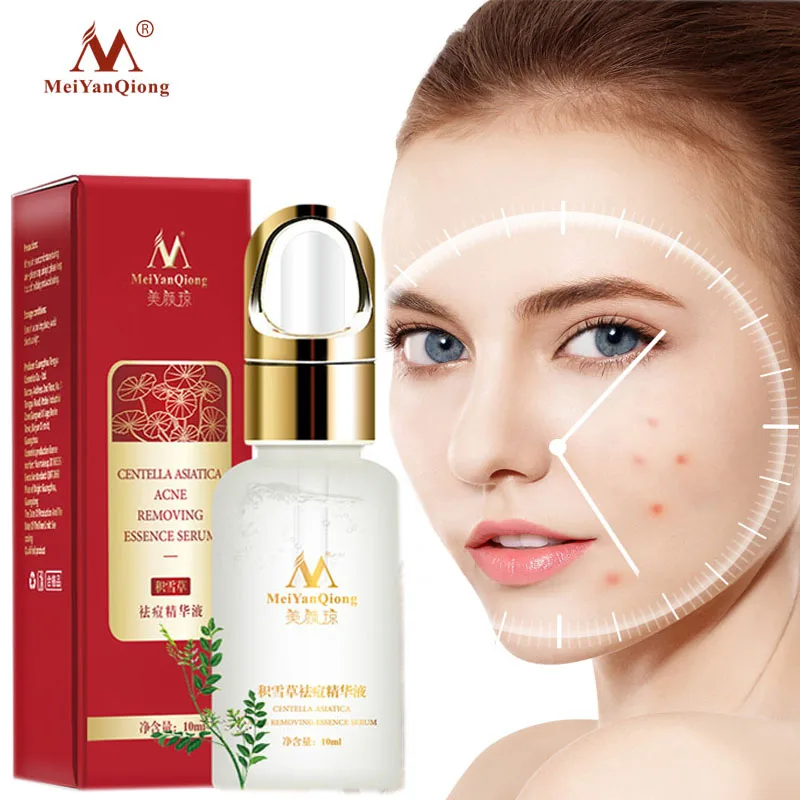 Лечение акне уход за кожей лица Сыворотки центеллы азиатской масляный