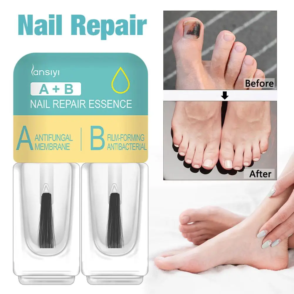 

Repair Nail Serum Anti Fungal Nail Remove Onychomycosis Nourishing Brighten Hand Toes Nail Care Repair Solution