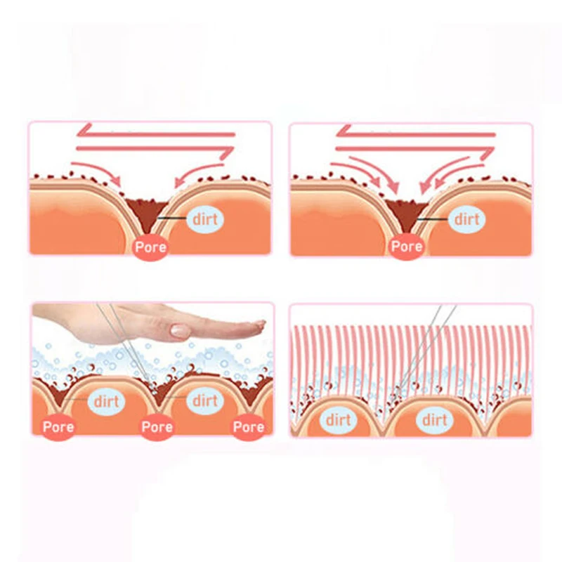 Аппарат для очистки лица 7 в 1 вакуумный аппарат ухода за кожей BIO светильник RF |