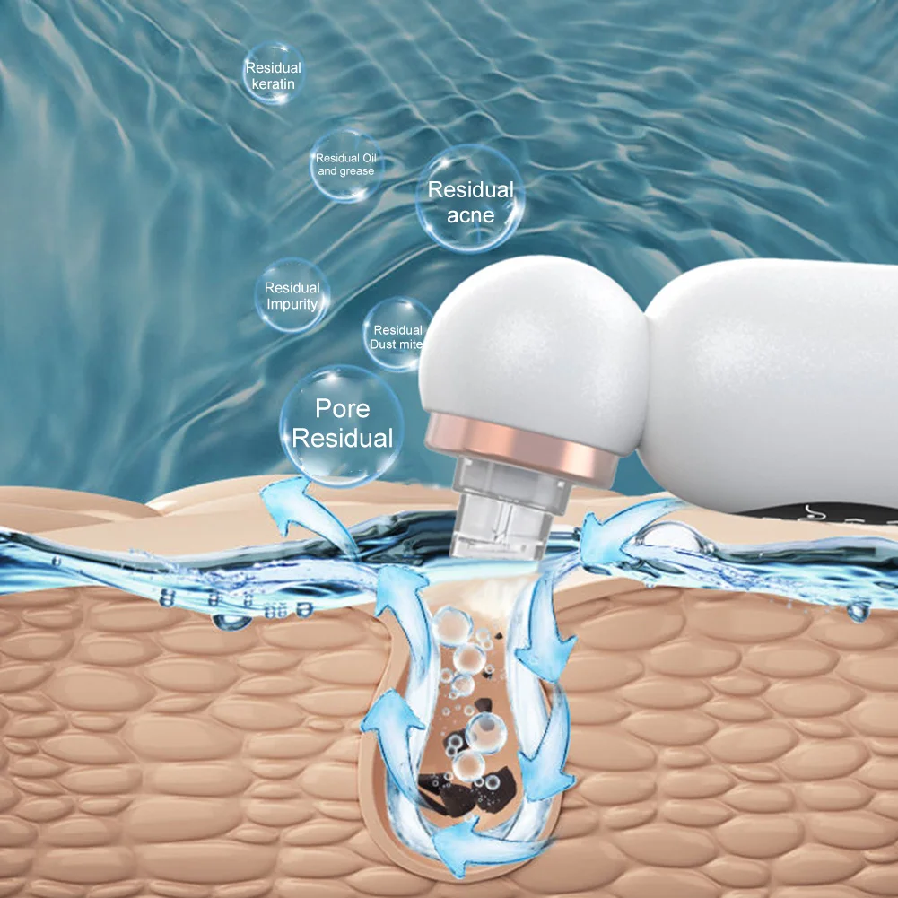 Электрический вакуумный очиститель для лица устройство удаления черных точек