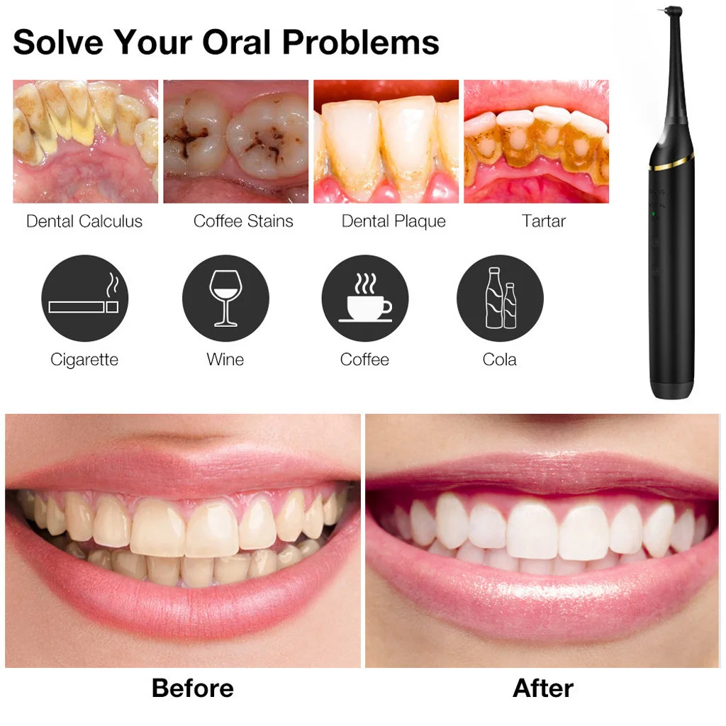 

Sonic Electric Toothbrush Smart Tooth Brush Ultrasonic Automatic Toothbrush Usb Teeth Cleaning Machine Cepillo Electrico Dientes