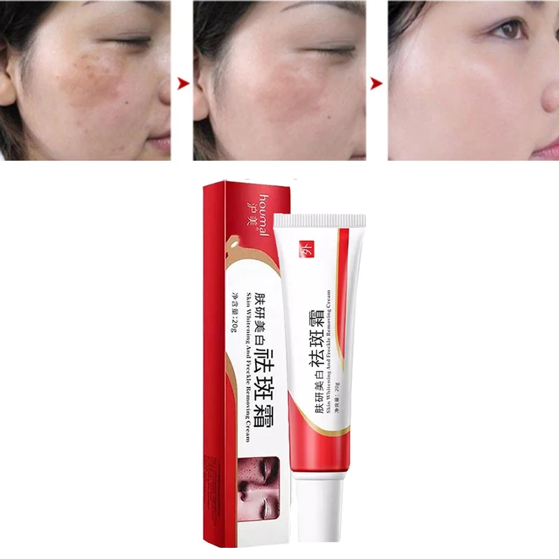 2 шт./лот отбеливающий крем для кожи с веснушкой эффективный пигмент мелазмы