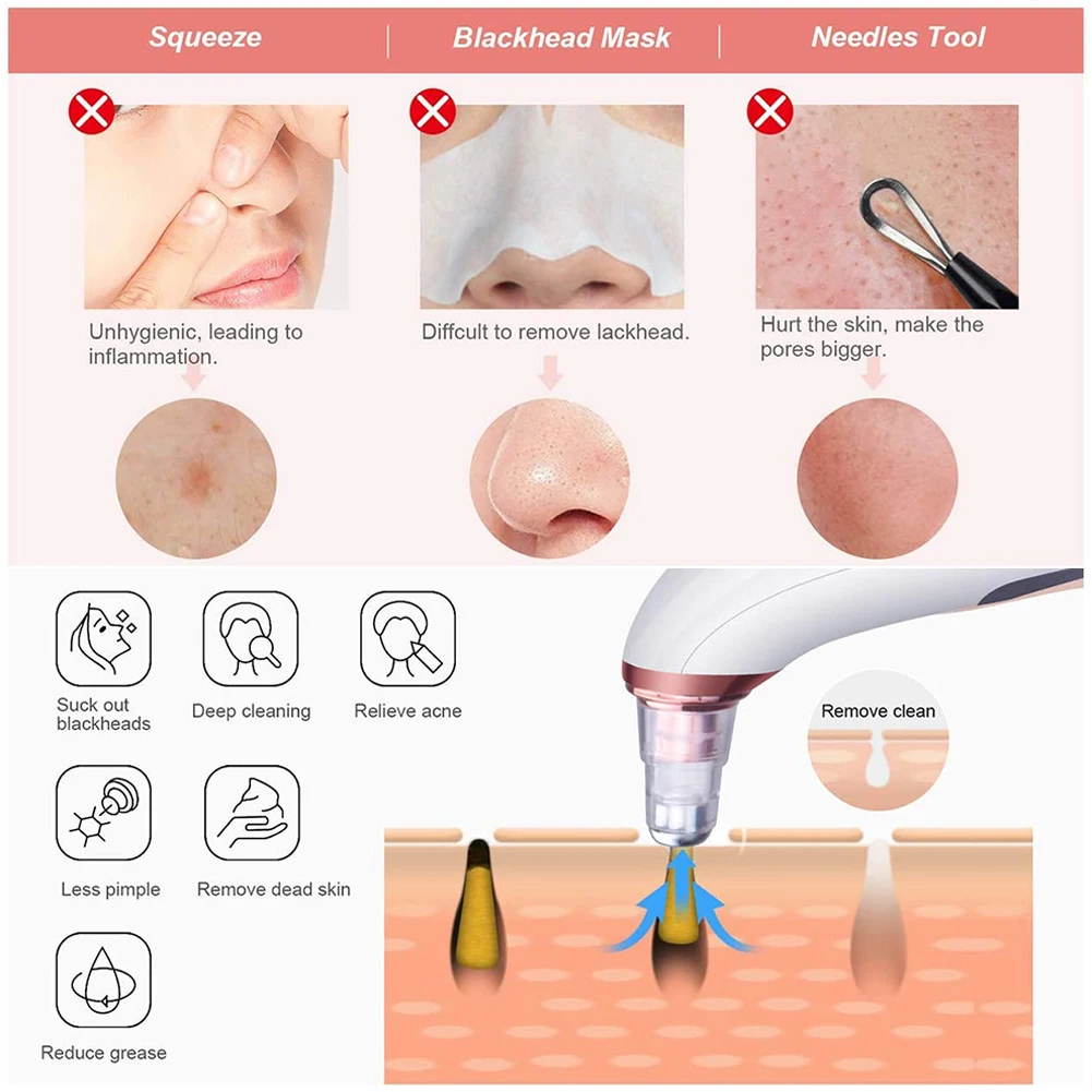 Аппарат вакуумный для удаления черных точек 7 в 1 с 6 головками | Красота и здоровье