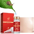 Высококачественная эссенция Snail100 % с гиалуроновой кислотой, жидкость для отбеливания, осветления пор, ампула, регенеративная эссенция против акне
