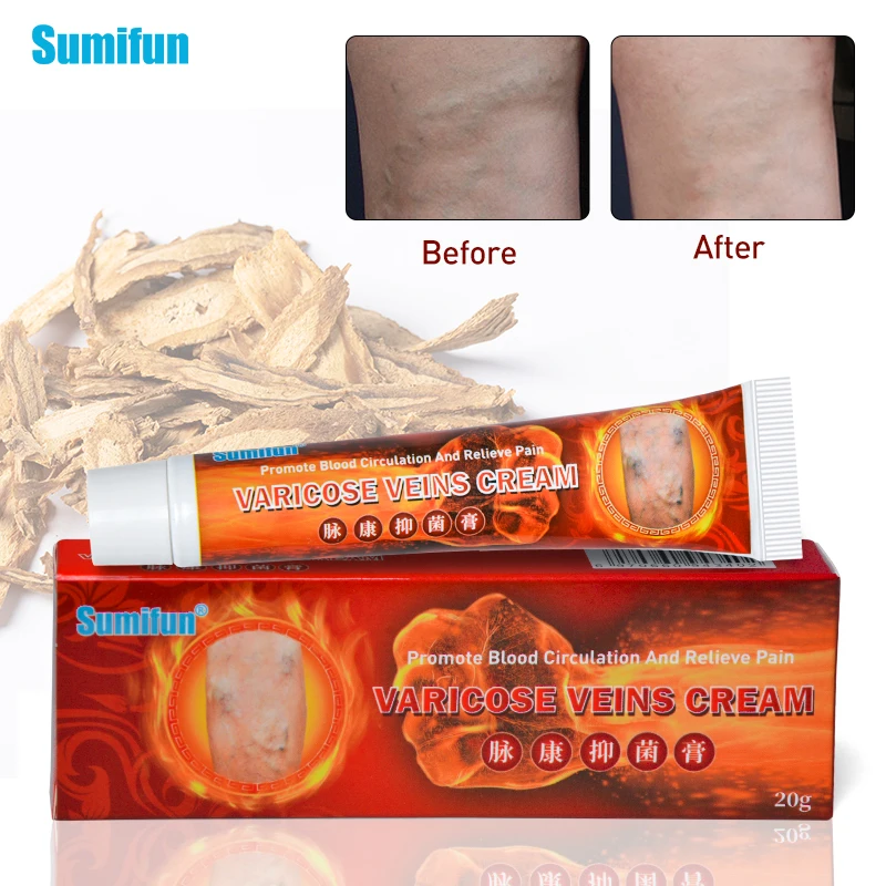 

1pcs Varicose Veins Treatment Herb Cream Cure Spider Veins Varicose Pain Plaster Varicosity Angiitis Ointment Health Care K10004