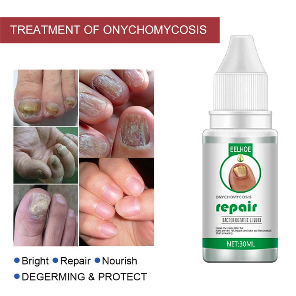 Сыворотка для лечения грибка ногтей от и восстановление способствует новому