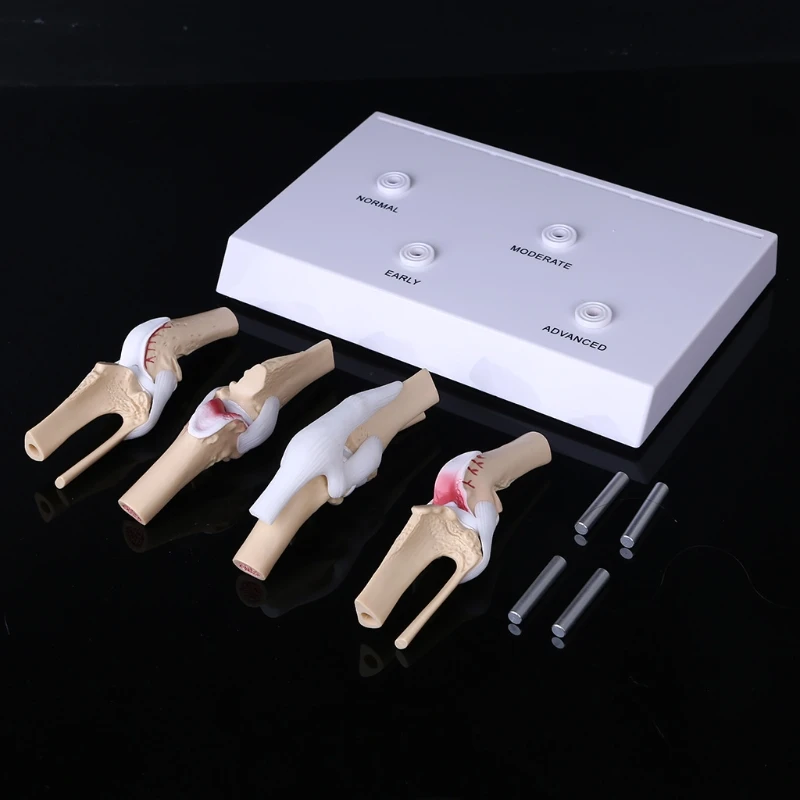 

Animal Dog Canine Knee Joint Model Skeleton Veterinary Teaching Research Display Instrument Study Teaching Tool 40JB